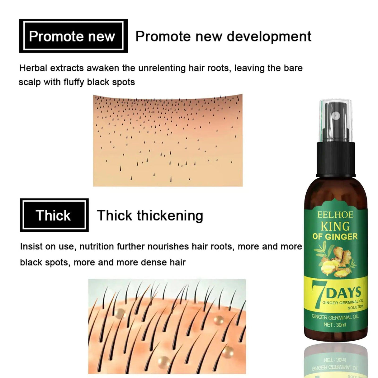 Ginger Hair Growth Serum Sprayer Hair Regrowth - Shoply