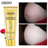 Stretch Mark Cream - Shoply