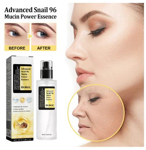 Snail Mucin 96% Power Repairing Essence - Shoply