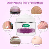 Scar Removal Cream